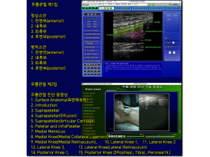 Musculoskeletal ultrasound diagnosis